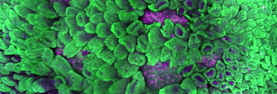 Image for Media Release | Snow Centre for Immune Health