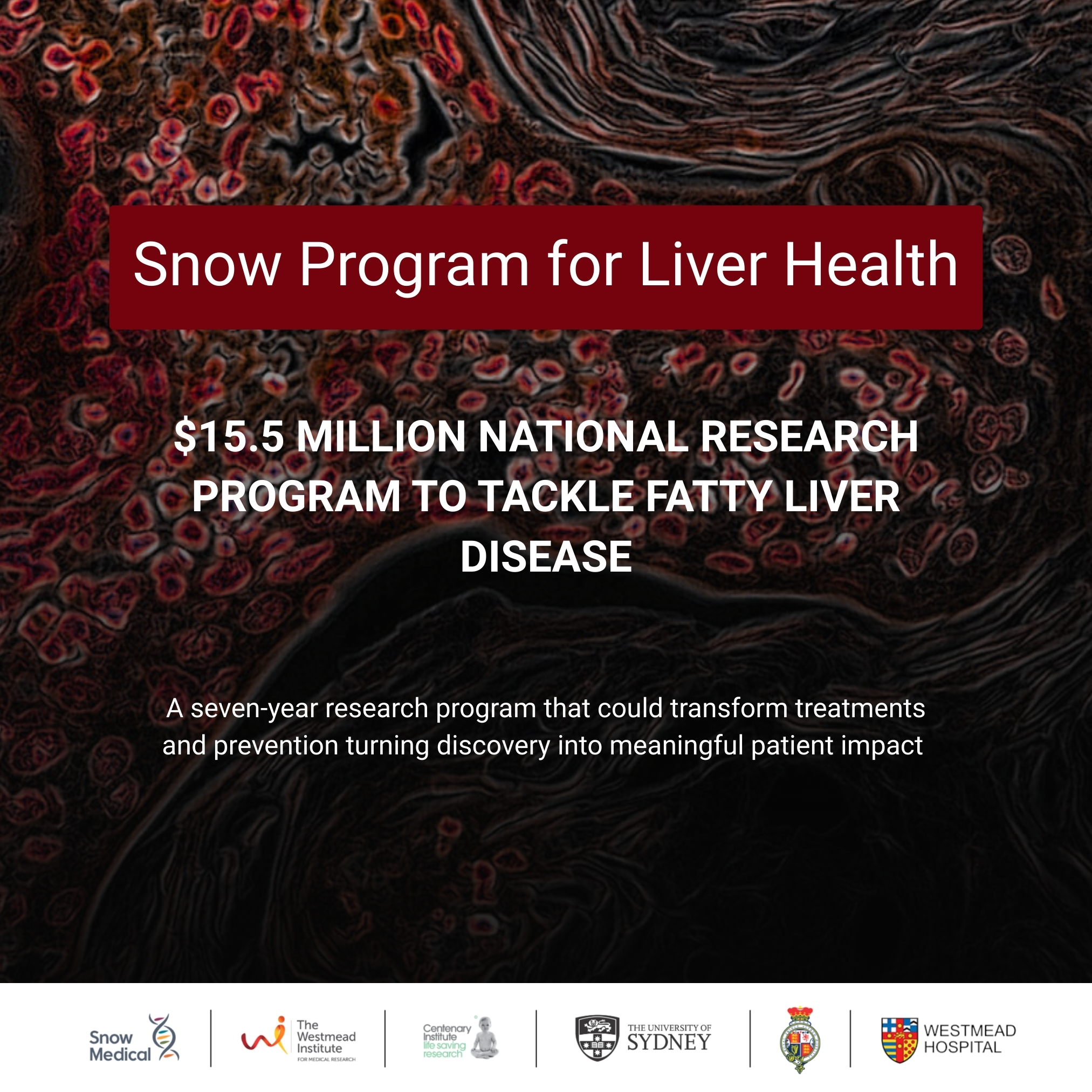 Image for Media Release | The Snow Program for Liver Health
