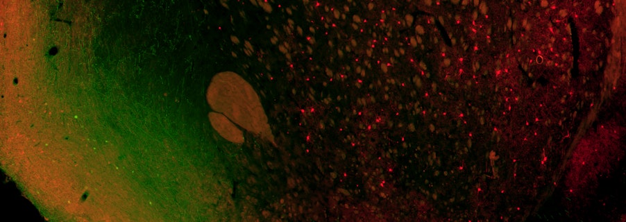 Image for Brain and Cognitive Health Program