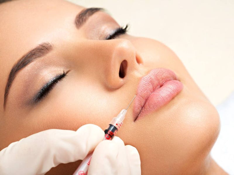 Lip Injection After Care Tips & Tricks
