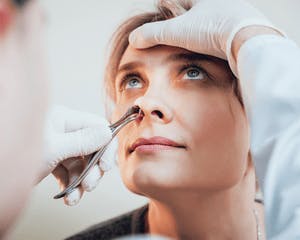 nonsurgical rhinoplasty