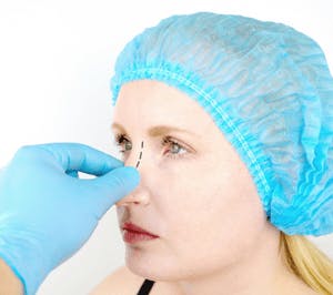 woman preparing for nose surgery