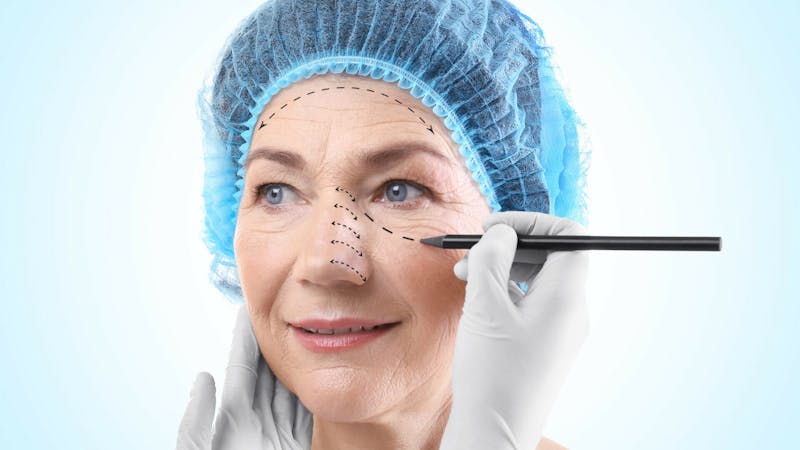 Senior Citizen Rhinoplasty: Guide & Recovery - Dr. Behrooz Torkian