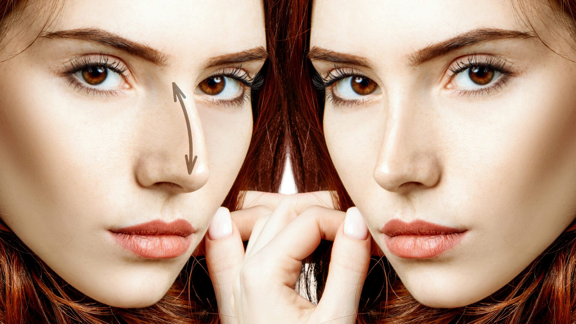 Affordable Nose Job Options in Beverly Hills Dr. Behrooz Torkian