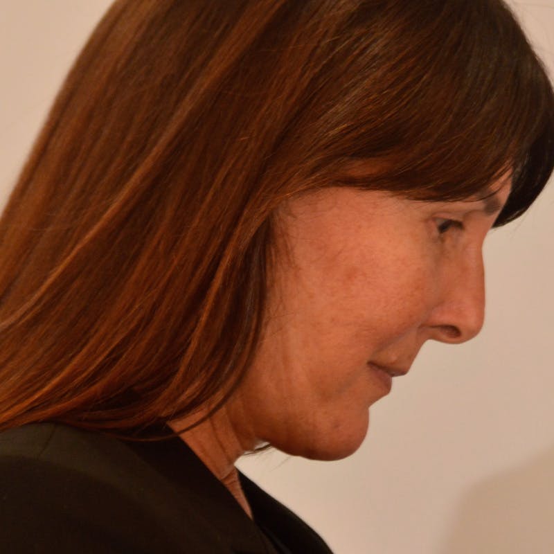 Facelift & Necklift Before & After Gallery - Patient 316007 - Image 8