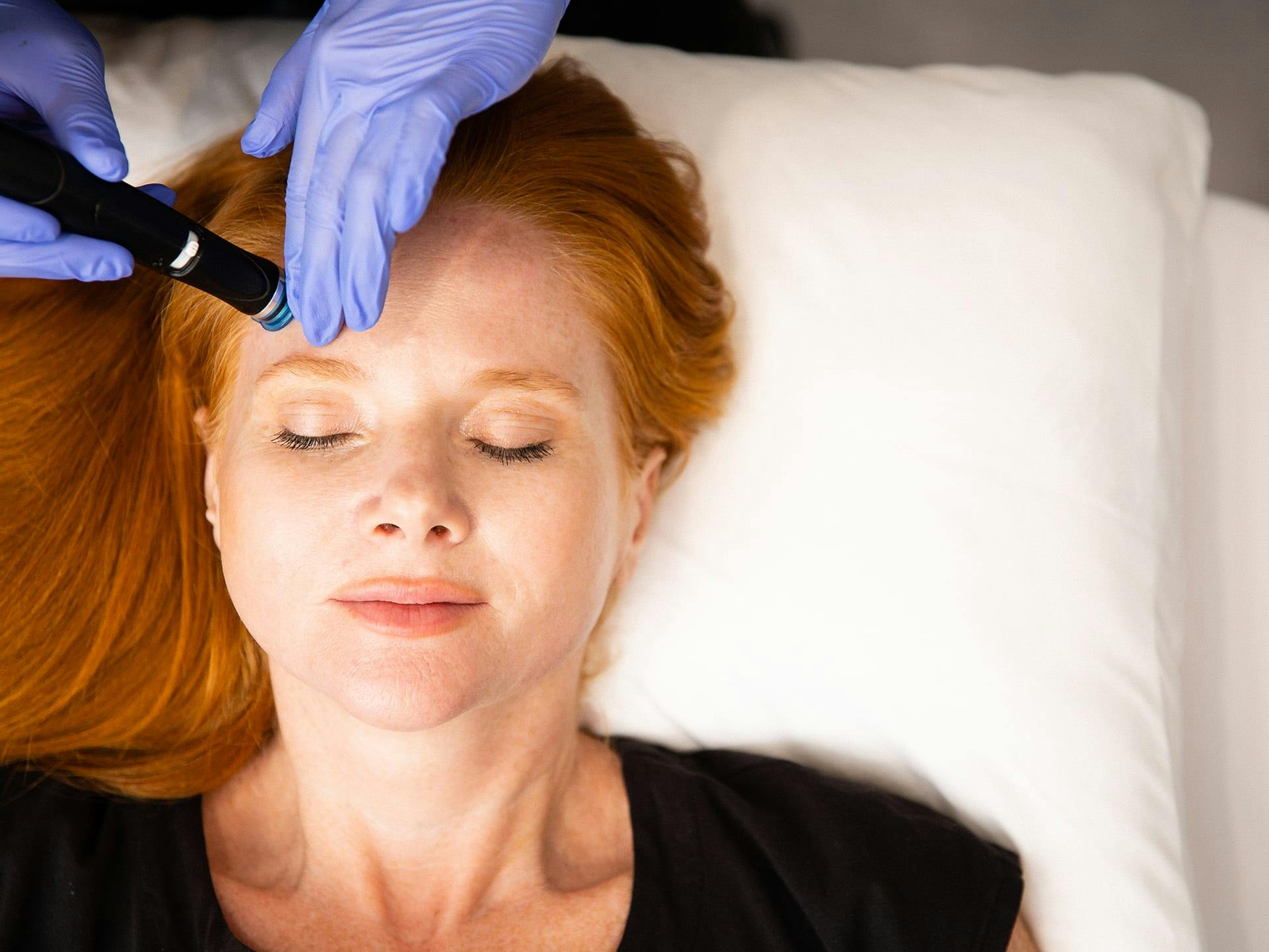 woman getting skin rejuvenation treatment