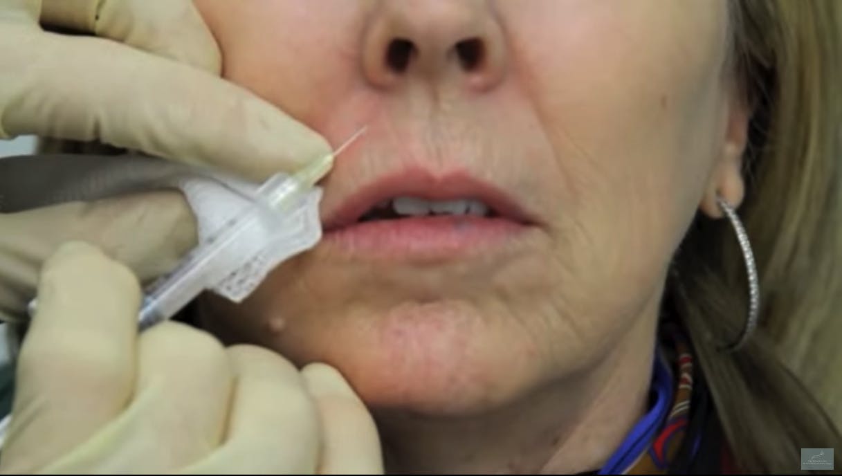 close up of woman getting injections