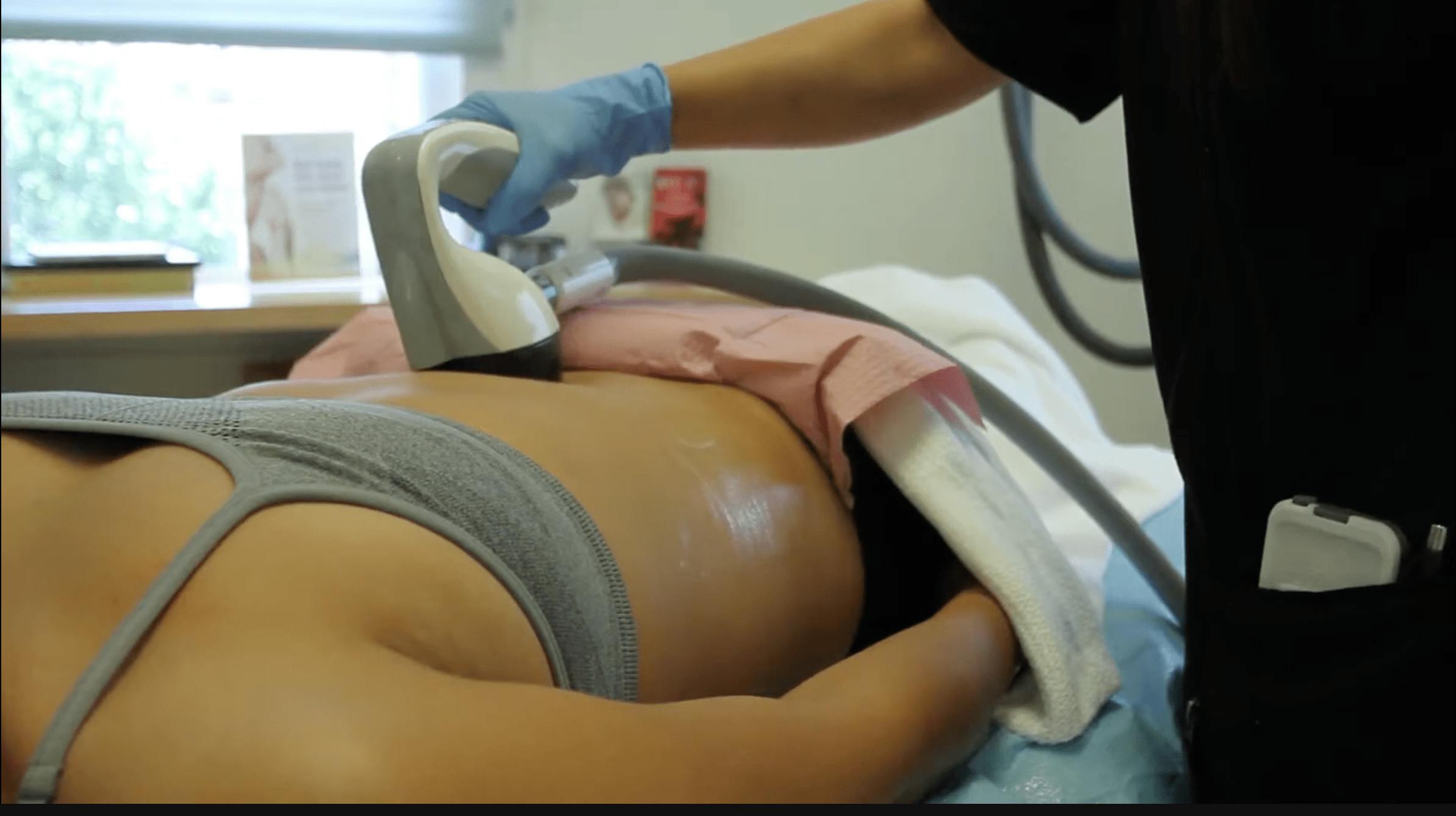 woman getting her a treatment on her stomach
