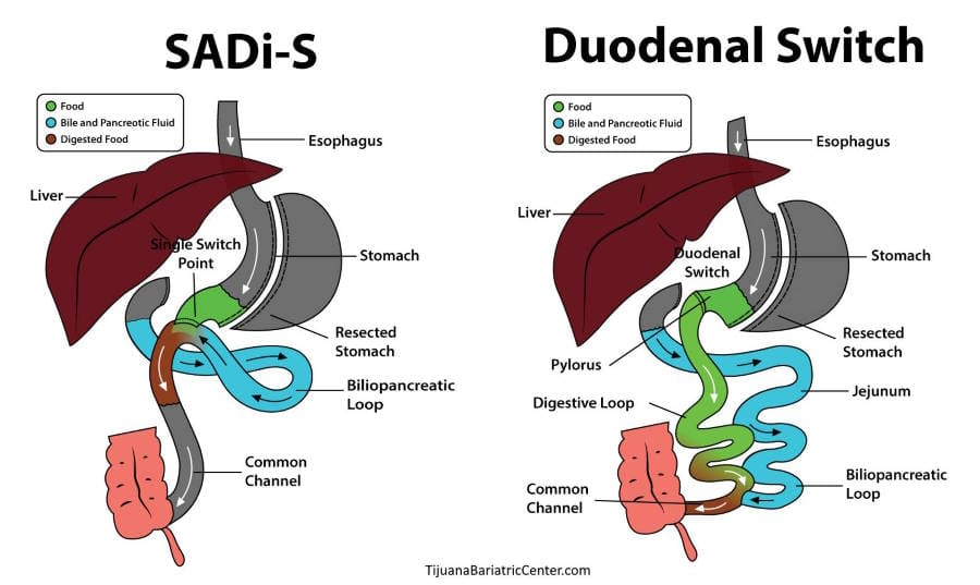 Human Anatomy Diagram