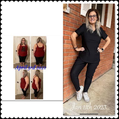 Bariatric Surgery Before & After Gallery - Patient 255082 - Image 1