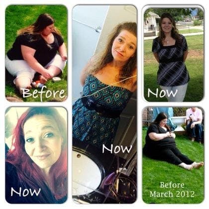 young woman on grass before and after gastric sleeve surgery
