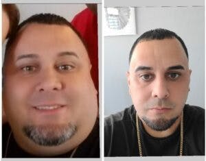 Ralf lost 153 lbs after his surgery