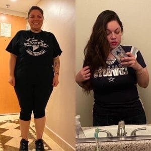 Roux-en-Y Gastric Bypass Surgery Results