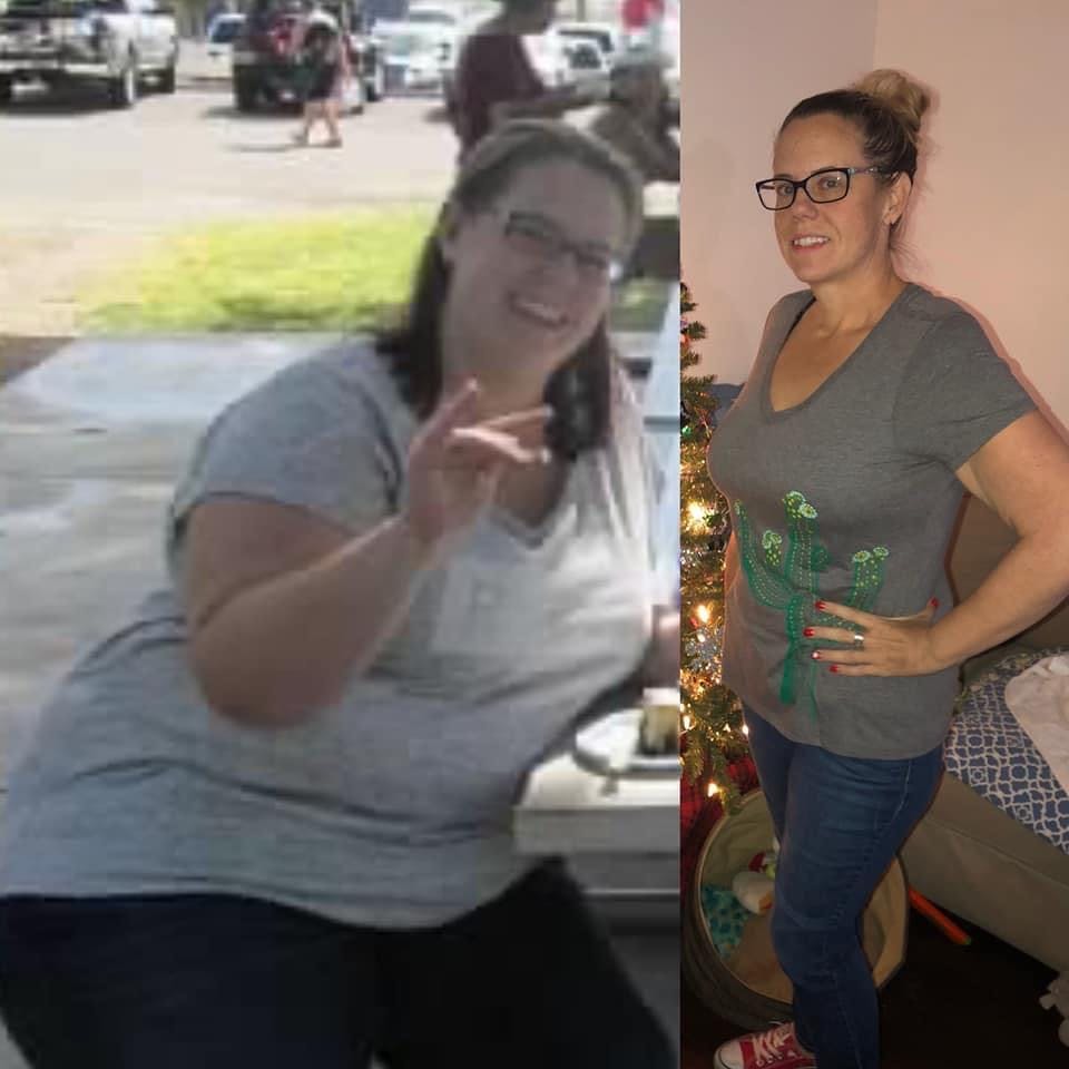 ladly-post bariatric surgery success 6