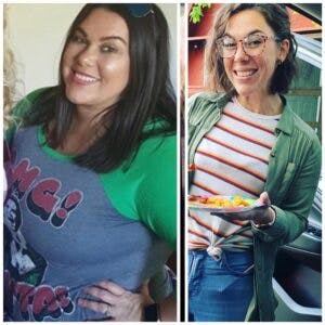 lady post gastric sleeve