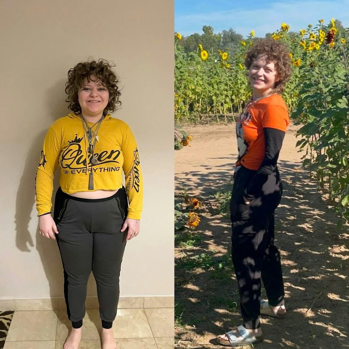 Bariatric Surgery Before & After Gallery - Patient 211787 - Image 1