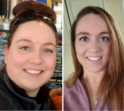 Bariatric Surgery Before & After Gallery - Patient 203793 - Image 1