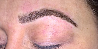 Eyebrow Microblading Before & After Gallery - Patient 644015 - Image 2