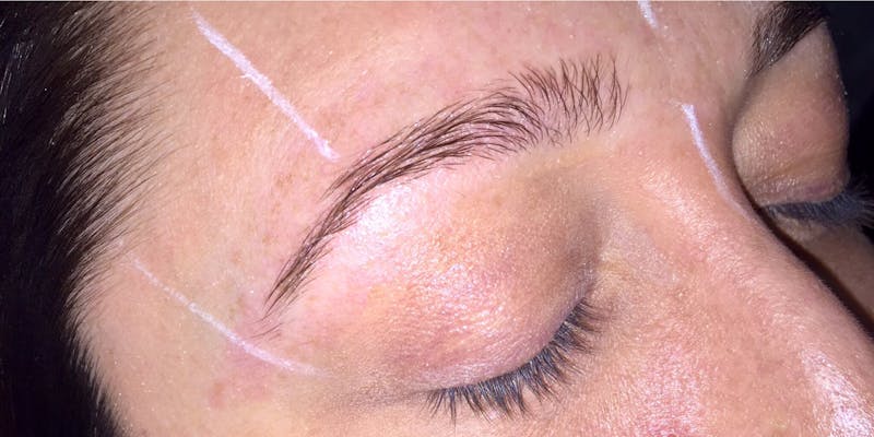 Eyebrow Microblading Before & After Gallery - Patient 644015 - Image 3
