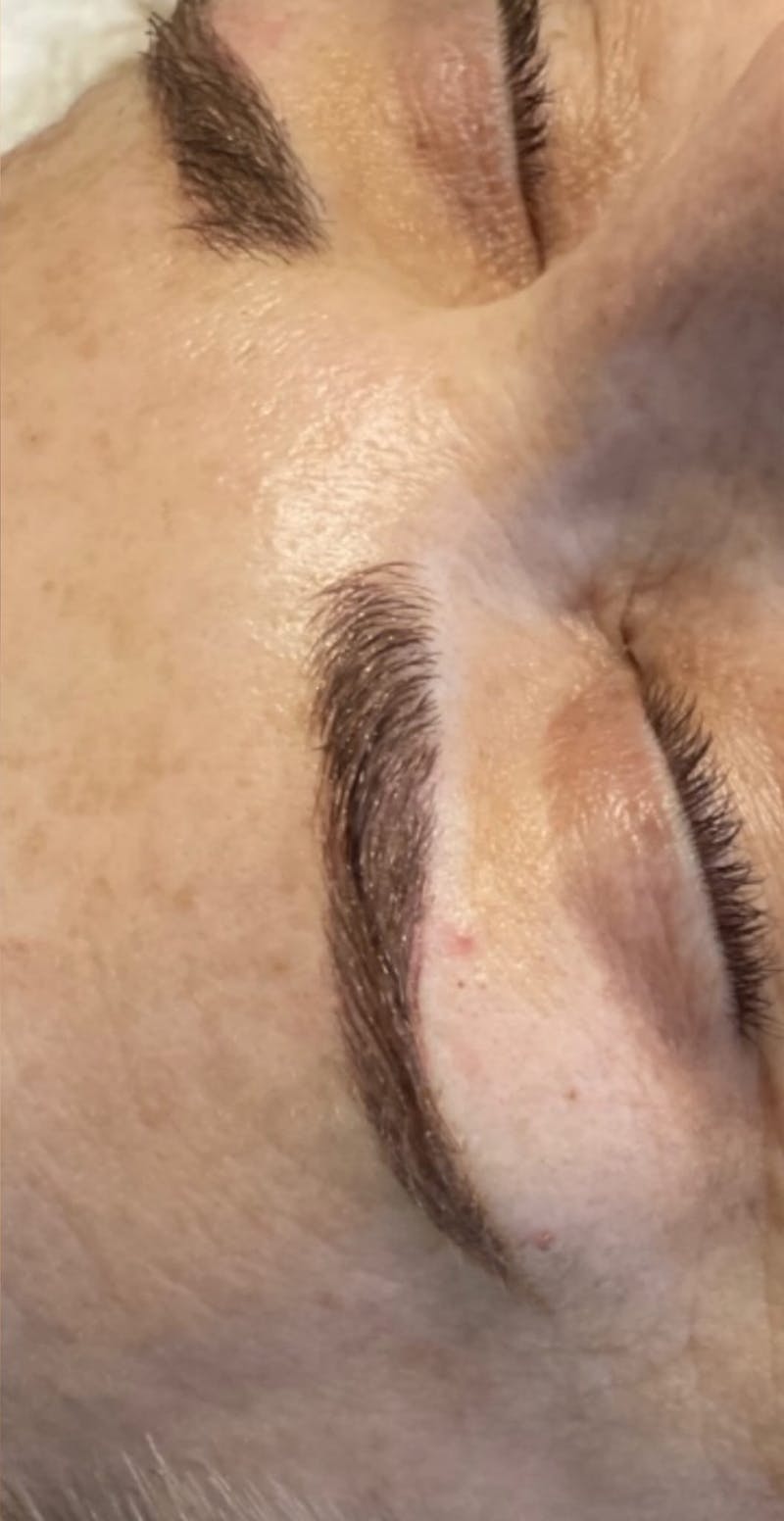 Eyebrow Microblading Before & After Gallery - Patient 282650 - Image 2