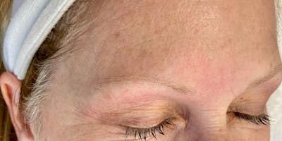 Eyebrow Microblading Before & After Gallery - Patient 222381 - Image 1