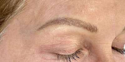 Eyebrow Microblading Before & After Gallery - Patient 222381 - Image 2