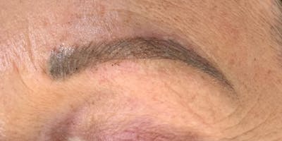 Eyebrow Microblading Before & After Gallery - Patient 333019 - Image 2