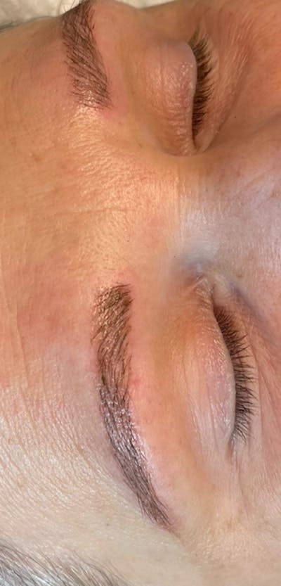 Eyebrow Microblading Before & After Gallery - Patient 206068 - Image 2