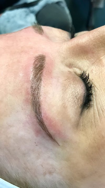 Eyebrow Microblading Before & After Gallery - Patient 347466 - Image 2