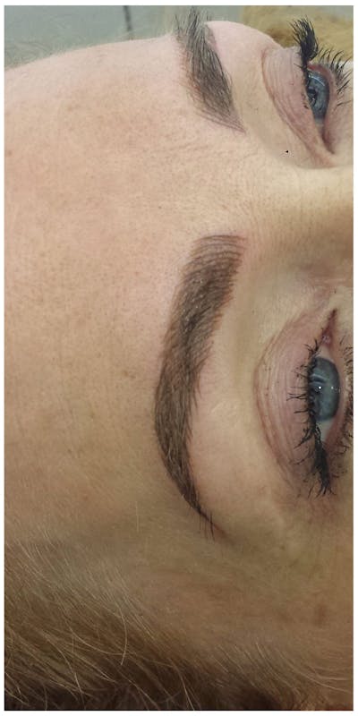 Eyebrow Microblading Before & After Gallery - Patient 359122 - Image 2