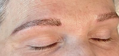 Eyebrow Microblading Before & After Gallery - Patient 899141 - Image 2