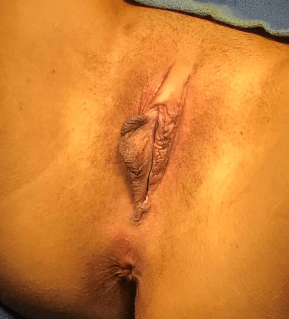 woman's labia