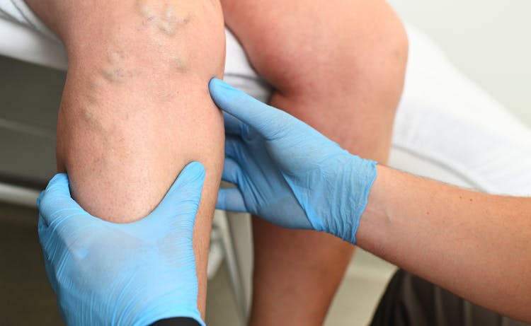 doctor with gloves inspecting clients legs