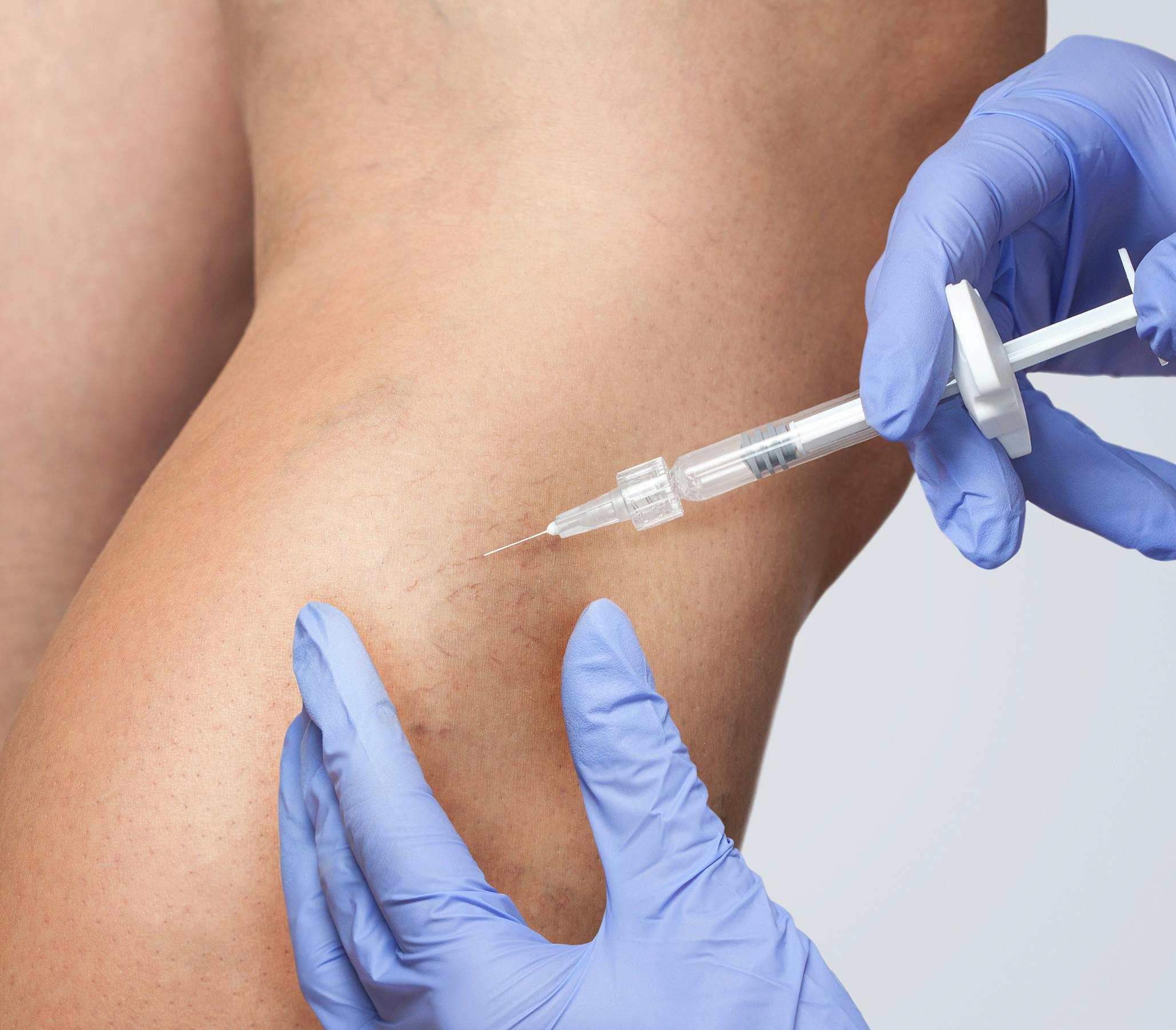 needle inserting into clients leg