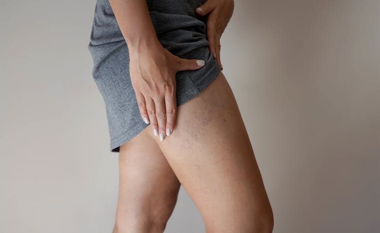 lady working on laptop