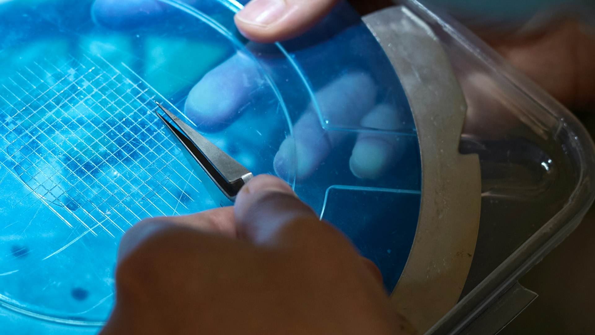 Brain Energy
Metabolism