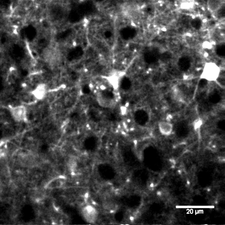 highres_RCaMPinsulin_GTP12_003_scalebar