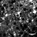 highres_RCaMPinsulin_GTP12_003_scalebar