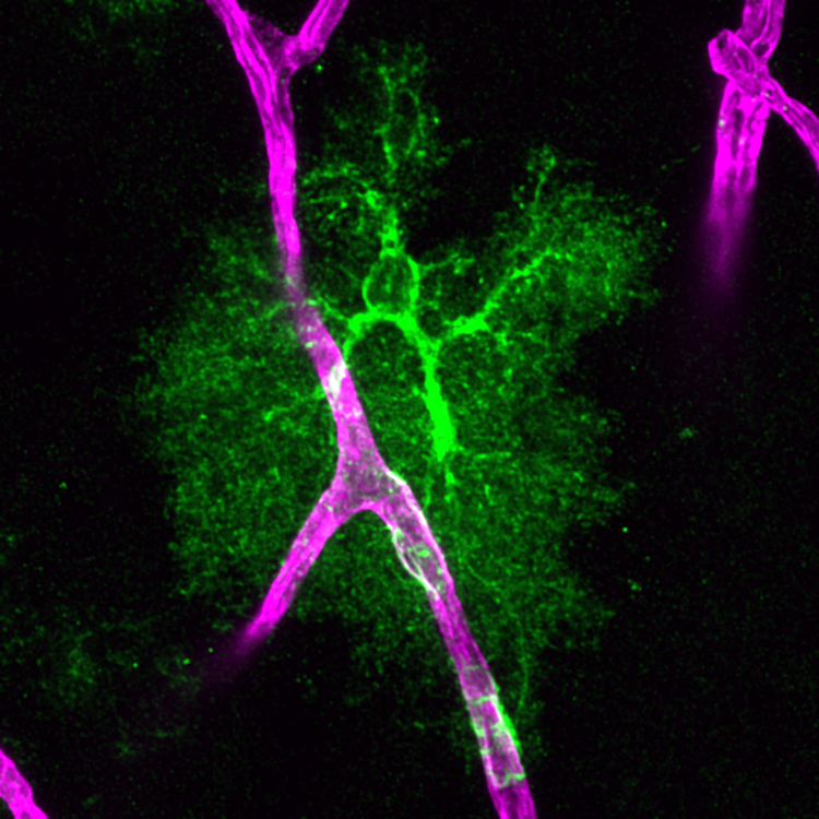 MAX_21.1.21_hippo_40x_z-1-1_2