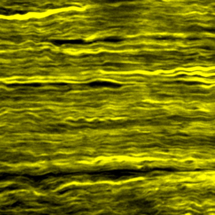 opticnerve opticnerve