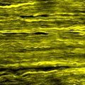 opticnerve