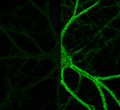orexin
