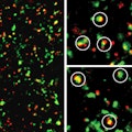 microglia