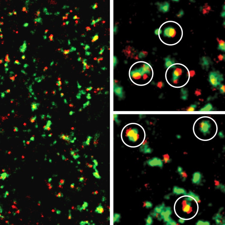 microglia