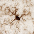 microglia