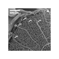 microvasculature