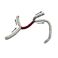 microstroke
