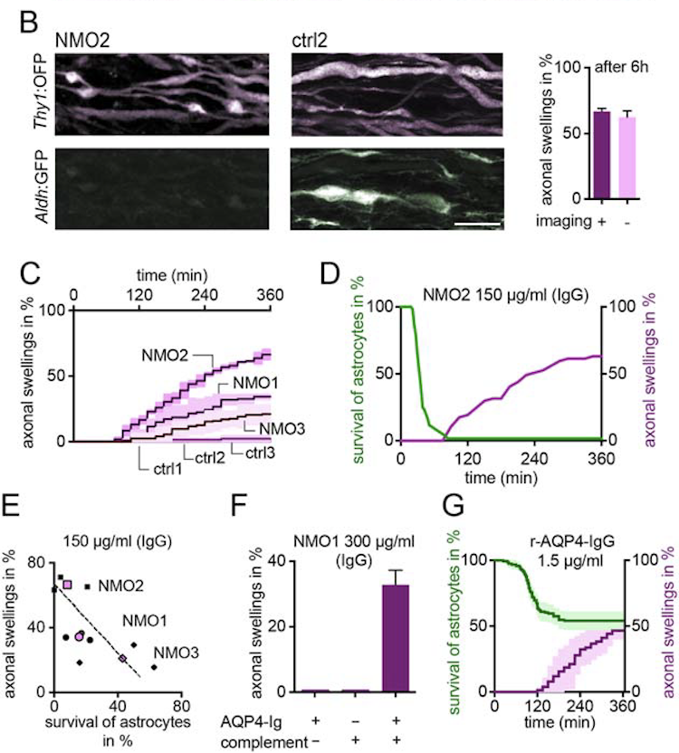 astrocyte depletion
