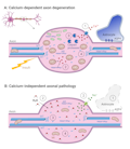 axon degeneration