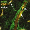 angiogenesis